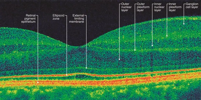OCT scan showing the labeled layers of the retina in cross-section
